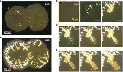 Live imaging of center of calcification formation during septum development in primary polyps of Acropora digitifera